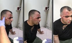 Korumları gazeteci Sinan Aygül'ü darbetmişti; AKP'li Geylani günler sonra özür diledi