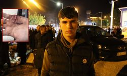 Kayyım protestolarında gözaltına alınan çocuğa polis şiddeti