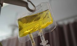 Sağlık Bakanlığı "sarı serum" uyarısı