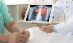35-50 yaş arası kadınlarda akciğer kanseri alarmı: Meme kanserinden sonra ikinci sıraya yükseldi