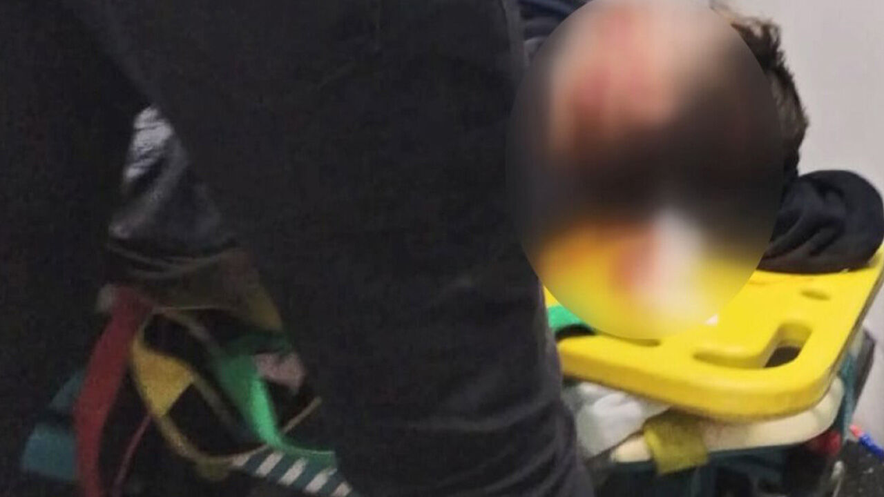 MESEM skandalı: Kafası sıkışan 14 yaşındaki çocuk yaşam savaşı veriyor